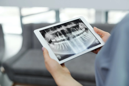 What Are the Benefits Of Regular Dental Visits?